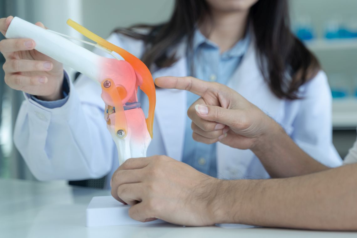 Eine Ärztin erklärt Arthrose anhand eines Kniemodells